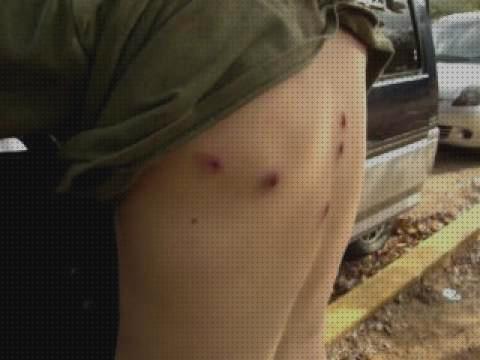 Las mejores airsoft heridas de pistola de airsoft