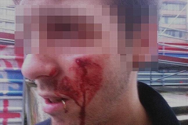 Las mejores pistolas balines pistola balines herido