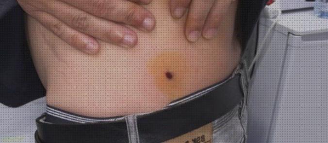 Las mejores balines pistola de balines lesiones