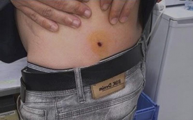 Las mejores marcas de perdigones pistola perdigones heridas